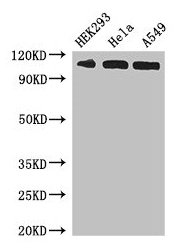 Western Blot  | Positive WB detected in: HEK293 whole cell lysate, Hela whole cell lysate, A549 whole cell lysate  | All lanes: IPO13 antibody at 3µg/ml  | Secondary  | Goat polyclonal to rabbit IgG at 1/50000 dilution  | Predicted band size: 109 kDa  | Observed band size: 109 kDa