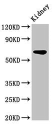 Western Blot | Positive WB detected in: Rat kidney tissue | All lanes: IPP antibody at 3.2μg/ml | Secondary | Goat polyclonal to rabbit IgG at 1/50000 dilution | Predicted band size: 66 kDa | Observed band size: 66 kDa