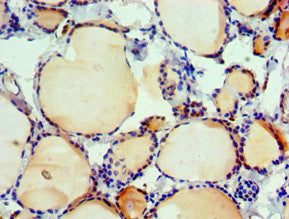 Immunohistochemistry of paraffin-embedded human thyroid tissue using the antibody at dilution of 1:100