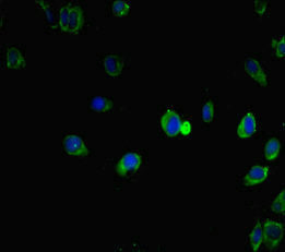 Immunofluorescent analysis of Hela cells using IRF5 Antibody at dilution of 1:100 and Alexa Fluor 488-congugated AffiniPure Goat Anti-Rabbit IgG(H+L)