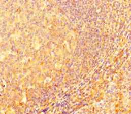 Immunohistochemistry of paraffin-embedded human tonsil tissue using IRF5 Antibody at dilution of 1:100