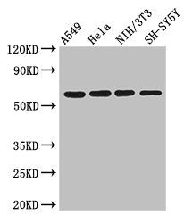 Western Blot | Positive WB detected in: A549 whole cell lysate, Hela whole cell lysate, NIH/3T3 whole cell lysate, SH-SY5Y whole cell lysate | All lanes: IRF5 antibody at 3μg/ml | Secondary | Goat polyclonal to rabbit IgG at 1/50000 dilution | Predicted band size: 57, 58, 55, 48, 18 kDa | Observed band size: 57 kDa