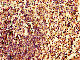 Immunohistochemistry of paraffin-embedded human spleen tissue using the antibody at dilution of 1:100