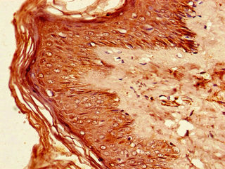 Immunohistochemistry of paraffin-embedded human skin tissue using IRF7 Antibody at dilution of 1:100