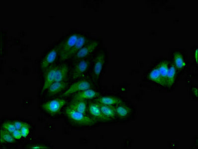 Immunofluorescent analysis of Hela cells using IRS2 Antibody at dilution of 1:100 and Alexa Fluor 488-congugated AffiniPure Goat Anti-Rabbit IgG(H+L)