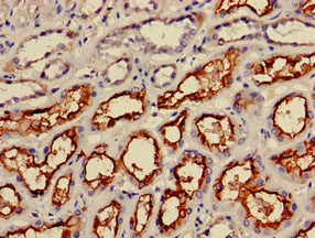 Immunohistochemistry of paraffin-embedded human kidney tissue using IRS2 Antibody at dilution of 1:100