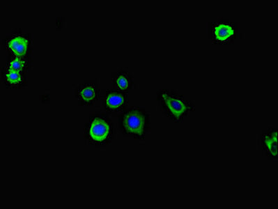 Immunofluorescent analysis of HepG2 cells using ITGA4 Antibody at dilution of 1:100 and Alexa Fluor 488-congugated AffiniPure Goat Anti-Rabbit IgG(H+L)