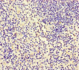 Immunohistochemistry of paraffin-embedded human spleen tissue using ITGA4 Antibody at dilution of 1:100