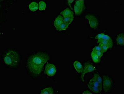 Immunofluorescent analysis of MCF-7 cells using ITGA5 Antibody at dilution of 1:100 and Alexa Fluor 488-congugated AffiniPure Goat Anti-Rabbit IgG(H+L)