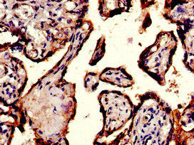 Immunohistochemistry of paraffin-embedded human placenta tissue using ITGA5 Antibody at dilution of 1:100