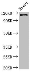 Western Blot | Positive WB detected in: Mouse heart tissue | All lanes: ITGA5 antibody at 4μg/ml | Secondary | Goat polyclonal to rabbit IgG at 1/50000 dilution | Predicted band size: 115 kDa | Observed band size: 115 kDa