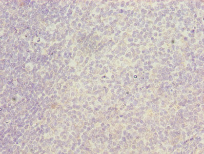 Immunohistochemistry of paraffin-embedded human tonsil tissue using ITGAL Antibody at dilution of 1:100