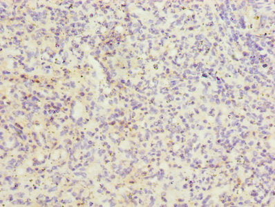 Immunohistochemistry of paraffin-embedded human spleen tissue using ITGAL Antibody at dilution of 1:100