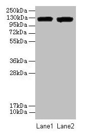 Western blot  | All lanes: ITGAL antibody at 8µg/ml  | Lane 1: A549 whole cell lysate  | Lane 2: HepG2 whole cell lysate  | Secondary  | Goat polyclonal to rabbit IgG at 1/10000 dilution  | Predicted band size: 129, 135, 120 kDa  | Observed band size: 129 kDa