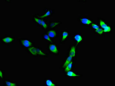 Immunofluorescent analysis of Hela cells using ITGAM Antibody at dilution of 1:100 and Alexa Fluor 488-congugated AffiniPure Goat Anti-Rabbit IgG(H+L)