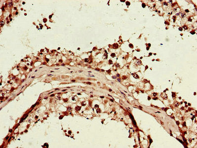 Immunohistochemistry of paraffin-embedded human testis tissue using ITGAM Antibody at dilution of 1:100