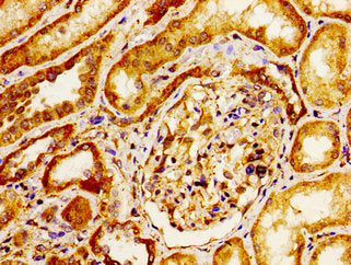 Immunohistochemistry of paraffin-embedded human kidney tissue using ITGAV Antibody at dilution of 1:100