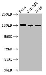 Western Blot  | Positive WB detected in: Hela whole cell lysate, Colo320 whole cell lysate, A549 whole cell lysate  | All lanes: ITGAV antibody at 2.7µg/ml  | Secondary  | Goat polyclonal to rabbit IgG at 1/50000 dilution  | Predicted band size: 117, 113, 112 kDa  | Observed band size: 130 kDa