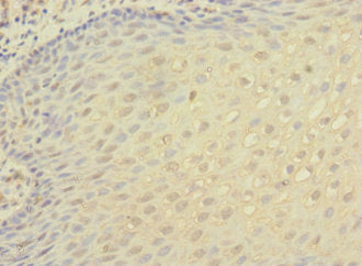Immunohistochemistry of paraffin-embedded human tonsil tissue using ITGAX Antibody at dilution of 1:100