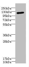 Western blot | All lanes: ITGAXantibody IgG at 1.59μg/ml + Mouse kidney tissue | Secondary | Goat polyclonal to rabbit IgG at 1/10000 dilution | Predicted band size: 128 kDa | Observed band size: 128 kDa