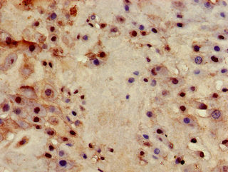 Immunohistochemistry of paraffin-embedded human placenta tissue using ITGB4 Antibody at dilution of 1:100