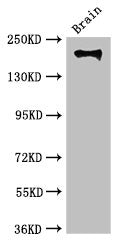Western Blot | Positive WB detected in: Mouse brain tissue | All lanes: ITGB4 antibody at 3.5μg/ml | Secondary | Goat polyclonal to rabbit IgG at 1/50000 dilution | Predicted band size: 203, 196, 201, 195, 107 kDa | Observed band size: 203 kDa