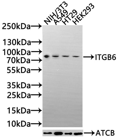 Western Blot | Positive WB detected in: Rat lung tissue | All lanes: ITGB6 antibody at 6.12μg/ml | Secondary | Goat polyclonal to rabbit IgG at 1/50000 dilution | Predicted band size: 86, 75 kDa | Observed band size: 86 kDa