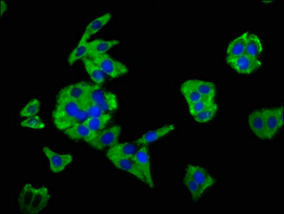 Immunofluorescence staining of HepG2 cells with MSN Antibody at 1:66, counter-stained with DAPI. The cells were fixed in 4% formaldehyde, permeabilized using 0.2% Triton X-100 and blocked in 10% normal Goat Serum. The cells were then incubated with the antibody overnight at 4°C. The secondary antibody was Alexa Fluor 488-congugated AffiniPure Goat Anti-Rabbit IgG(H+L).Rabbit anti-Human MSN Polyclonal Antibody