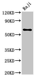 Western Blot | Positive WB detected in: Raji whole cell lysate | All lanes: MSN antibody at 5.7μg/ml | Secondary | Goat polyclonal to rabbit IgG at 1/50000 dilution | Predicted band size: 68 kDa | Observed band size: 68 kDaRabbit anti-Human MSN Polyclonal Antibody