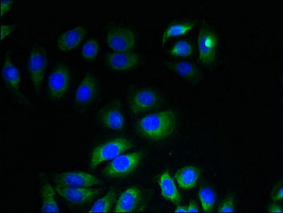 Immunofluorescent analysis of A549 cells using ITM2A Antibody at dilution of 1:100 and Alexa Fluor 488-congugated AffiniPure Goat Anti-Rabbit IgG(H+L)