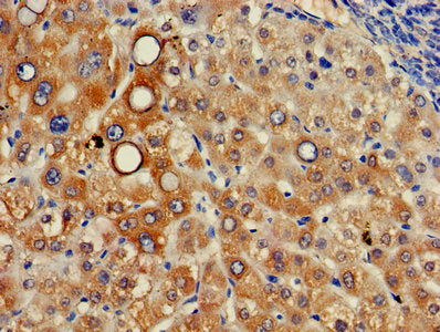 Immunohistochemistry of paraffin-embedded human liver tissue using ITM2A Antibody at dilution of 1:100
