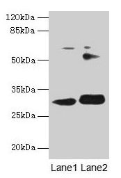 Western blot  | All lanes: ITM2A antibody at 0.3µg/ml  | Lane 1: HL60 whole cell lysate  | Lane 2: SH-SY5Y whole cell lysate  | Secondary  | Goat polyclonal to rabbit IgG at 1/10000 dilution  | Predicted band size: 30, 25 kDa  | Observed band size: 30 kDa