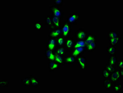Immunofluorescence staining of Hela cells with ITM2B Antibody at 1:133, counter-stained with DAPI. The cells were fixed in 4% formaldehyde, permeabilized using 0.2% Triton X-100 and blocked in 10% normal Goat Serum. The cells were then incubated with the antibody overnight at 4°C. The secondary antibody was Alexa Fluor 488-congugated AffiniPure Goat Anti-Rabbit IgG(H+L).Rabbit anti-Human ITM2B Polyclonal Antibody