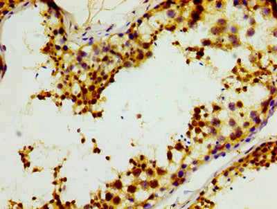 IHC image of the antibody diluted at 1:400 and staining in paraffin-embedded human testis tissue performed on a Leica BondTM system. After dewaxing and hydration, antigen retrieval was mediated by high pressure in a citrate buffer (pH 6.0). Section was blocked with 10% normal goat serum 30min at RT. Then primary antibody (1% BSA) was incubated at 4°C overnight. The primary is detected by a biotinylated secondary antibody and visualized using an HRP conjugated SP system.