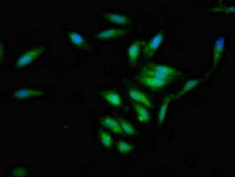 Immunofluorescent analysis of Hela cells using IVL Antibody at dilution of 1:100 and Alexa Fluor 488-congugated AffiniPure Goat Anti-Rabbit IgG(H+L)
