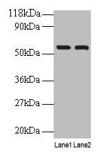 Western blot  | All lanes: IMPDH2 antibody at 2µg/ml  | Lane 1: EC109 whole cell lysate  | Lane 2: 293T whole cell lysate  | Secondary  | Goat polyclonal to rabbit IgG at 1/15000 dilution  | Predicted band size: 56 kDa  | Observed band size: 56 kDaRabbit anti-Human IMPDH2 Polyclonal Antibody