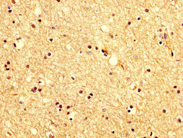 IHC image of KCNAB1 Antibody diluted at 1:200 and staining in paraffin-embedded human brain tissue performed on a Leica BondTM system. After dewaxing and hydration, antigen retrieval was mediated by high pressure in a citrate buffer (pH 6.0). Section was blocked with 10% normal goat serum 30min at RT. Then primary antibody (1% BSA) was incubated at 4°C overnight. The primary is detected by a biotinylated secondary antibody and visualized using an HRP conjugated SP system.