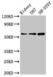 Western Blot  | Positive WB detected in: Mouse kidney tissue, U87 whole cell lysate, SH-SY5Y whole cell lysate  | All lanes: KCNAB1 antibody at 3.9µg/ml  | Secondary  | Goat polyclonal to rabbit IgG at 1/50000 dilution  | Predicted band size: 47, 45, 46 kDa  | Observed band size: 60 kDa