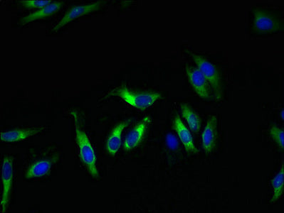 Immunofluorescent analysis of Hela cells using KCND1 Antibody at dilution of 1:100 and Alexa Fluor 488-congugated AffiniPure Goat Anti-Rabbit IgG(H+L)