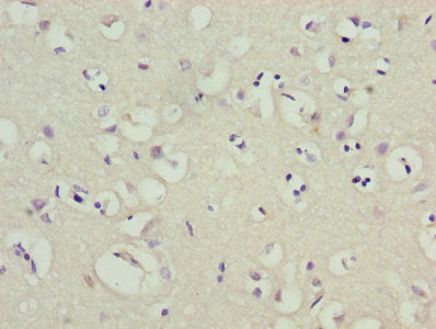 Immunohistochemistry of paraffin-embedded human brain tissue using the antibody at dilution of 1:100