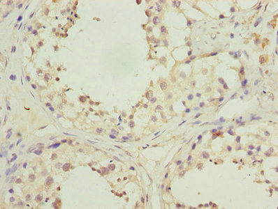 Immunohistochemistry of paraffin-embedded human testis tissue using KCND1 Antibody at dilution of 1:100