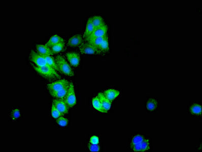 Immunofluorescent analysis of HepG2 cells using KCNIP3 Antibody at dilution of 1:100 and Alexa Fluor 488-congugated AffiniPure Goat Anti-Rabbit IgG(H+L)
