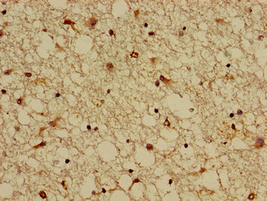 Immunohistochemistry of paraffin-embedded human brain tissue using KCNIP3 Antibody at dilution of 1:100