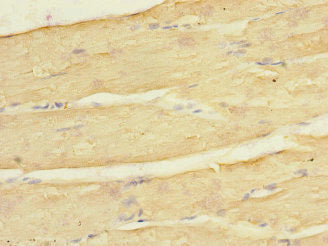 Immunohistochemistry of paraffin-embedded human skeletal muscle tissue using KCNJ4 Antibody at dilution of 1:100