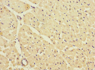 Immunohistochemistry of paraffin-embedded human heart tissue using KCNJ4 Antibody at dilution of 1:100