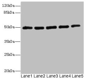 Western blot  | All lanes: KCNJ4 antibody at 2.04µg/ml  | Lane 1: Hela whole cell lysate  | Lane 2: 293T whole cell lysate  | Lane 3: HepG2 whole cell lysate  | Lane 4: Jurkat whole cell lysate  | Lane 5: MCF-7 whole cell lysate  | Secondary  | Goat polyclonal to rabbit IgG at 1/10000 dilution  | Predicted band size: 50 kDa  | Observed band size: 50 kDa