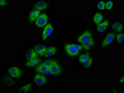 Immunofluorescence staining of A549 cells with KCNJ5 Antibody at 1:100, counter-stained with DAPI. The cells were fixed in 4% formaldehyde, permeabilized using 0.2% Triton X-100 and blocked in 10% normal Goat Serum. The cells were then incubated with the antibody overnight at 4°C. The secondary antibody was Alexa Fluor 488-congugated AffiniPure Goat Anti-Rabbit IgG(H+L).