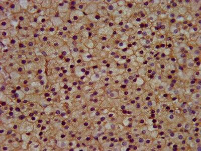 IHC image of KCNJ5 Antibody diluted at 1:300 and staining in paraffin-embedded human adrenal gland tissue performed on a Leica BondTM system. After dewaxing and hydration, antigen retrieval was mediated by high pressure in a citrate buffer (pH 6.0). Section was blocked with 10% normal goat serum 30min at RT. Then primary antibody (1% BSA) was incubated at 4°C overnight. The primary is detected by a biotinylated secondary antibody and visualized using an HRP conjugated SP system.