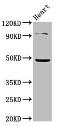 Western Blot | Positive WB detected in: Mouse heart tissue | All lanes: KCNJ5 antibody at 4.85μg/ml | Secondary | Goat polyclonal to rabbit IgG at 1/50000 dilution | Predicted band size: 48 kDa | Observed band size: 48 kDa