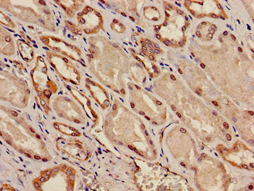 Immunohistochemistry of paraffin-embedded human kidney tissue using KCNK1 Antibody at dilution of 1:100